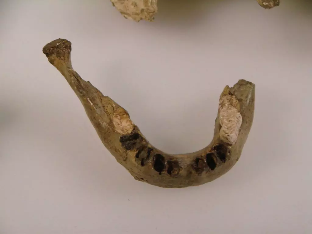Il Neanderthal: il Primo Dentista della Storia che Usava un Trapano di Pietra
